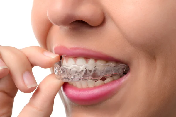How to Choose the Right Invisalign Provider: Tips for Finding an Experienced Orthodontist