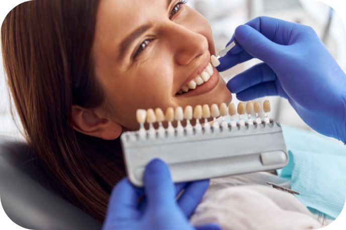 Veneers